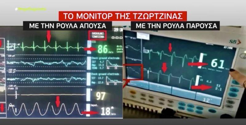 Ντοκουμέντο: Τι έδειχνει το μόνιτορ της Τζωρτζίνας όταν ήταν δίπλα της η Πισπιρίγκου και τι όταν δεν ήταν (vid)