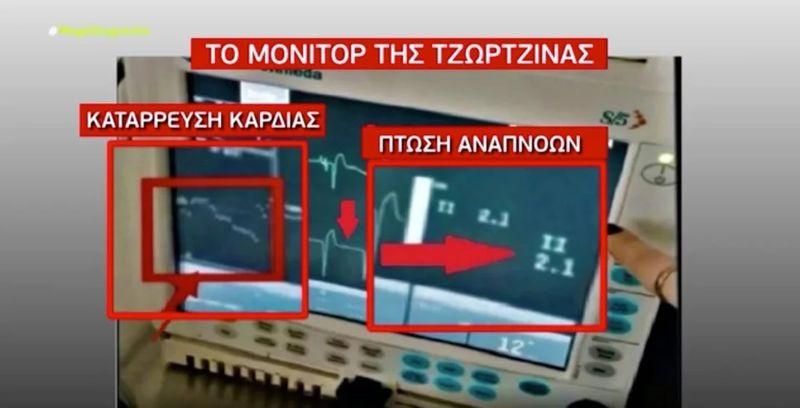 Ντοκουμέντο: Τι έδειχνει το μόνιτορ της Τζωρτζίνας όταν ήταν δίπλα της η Πισπιρίγκου και τι όταν δεν ήταν (vid)