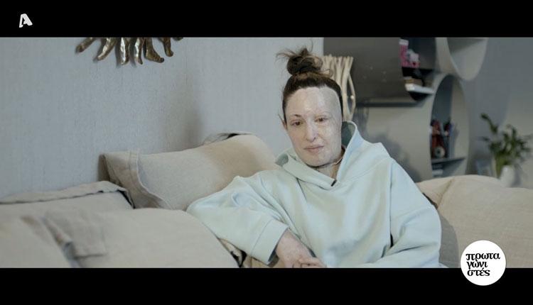 Η Ιωάννα Παλιοσπύρου για πρώτη φορά χωρίς την μάσκα της (vids)